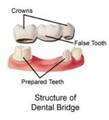 Bridges at Claremorris Dental Care
