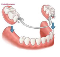 Dentures at Claremorris Dental Care Dentures at Claremorris Dental Care